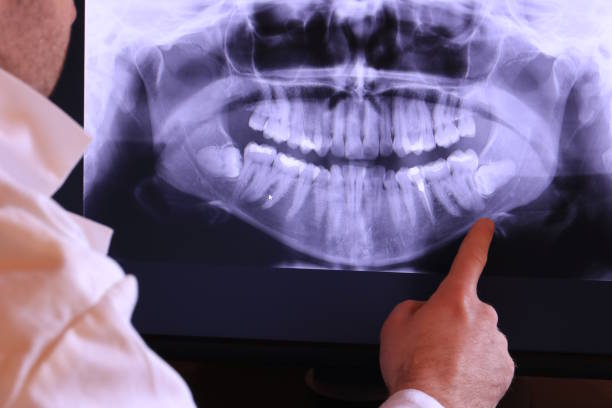 Best Emergency Broken Tooth Repair in Lorenzo, TX